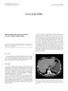 Massive upper gastrointestinal bleeding secondary to gastrosplenic fistula.pdf.jpg